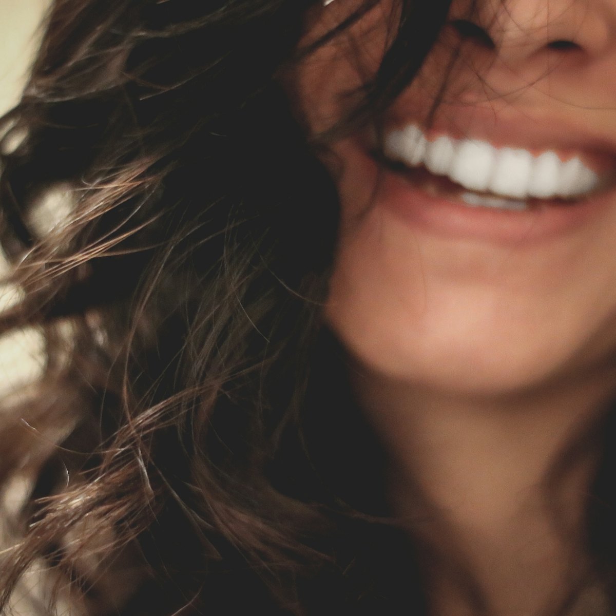 Restauração estética do sorriso — depois